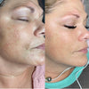 Essential NanoFacial